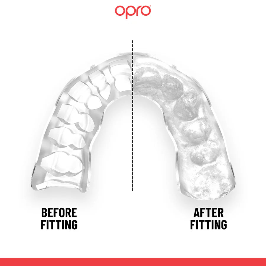 OPRO Instant Custom Fit Mouthguard - Black