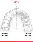 OPRO Instant Custom Fit Tannbeskytter